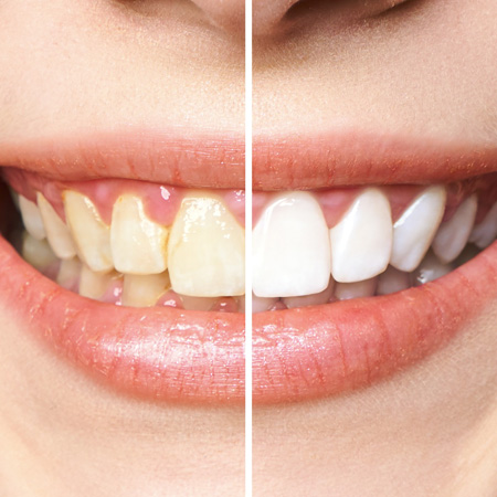 Matéria da Araújo | Clínica Odontologia e Estética | Maceió | Alagoas